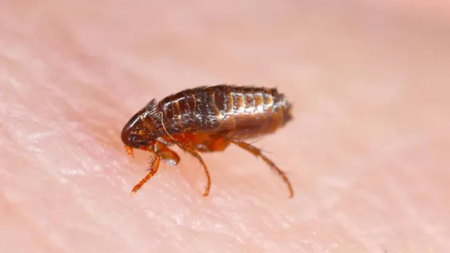 US Resident Tests Positive for Plague: Symptoms, Types, and Prevention Explained