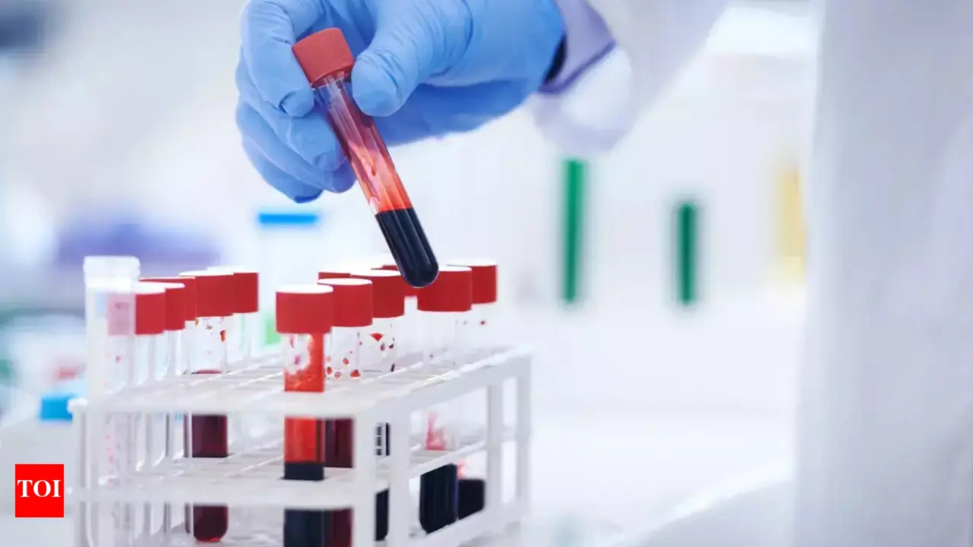 Simple Blood Test Detects Head and Neck Cancers Up to 10 Years Before Symptoms Appear