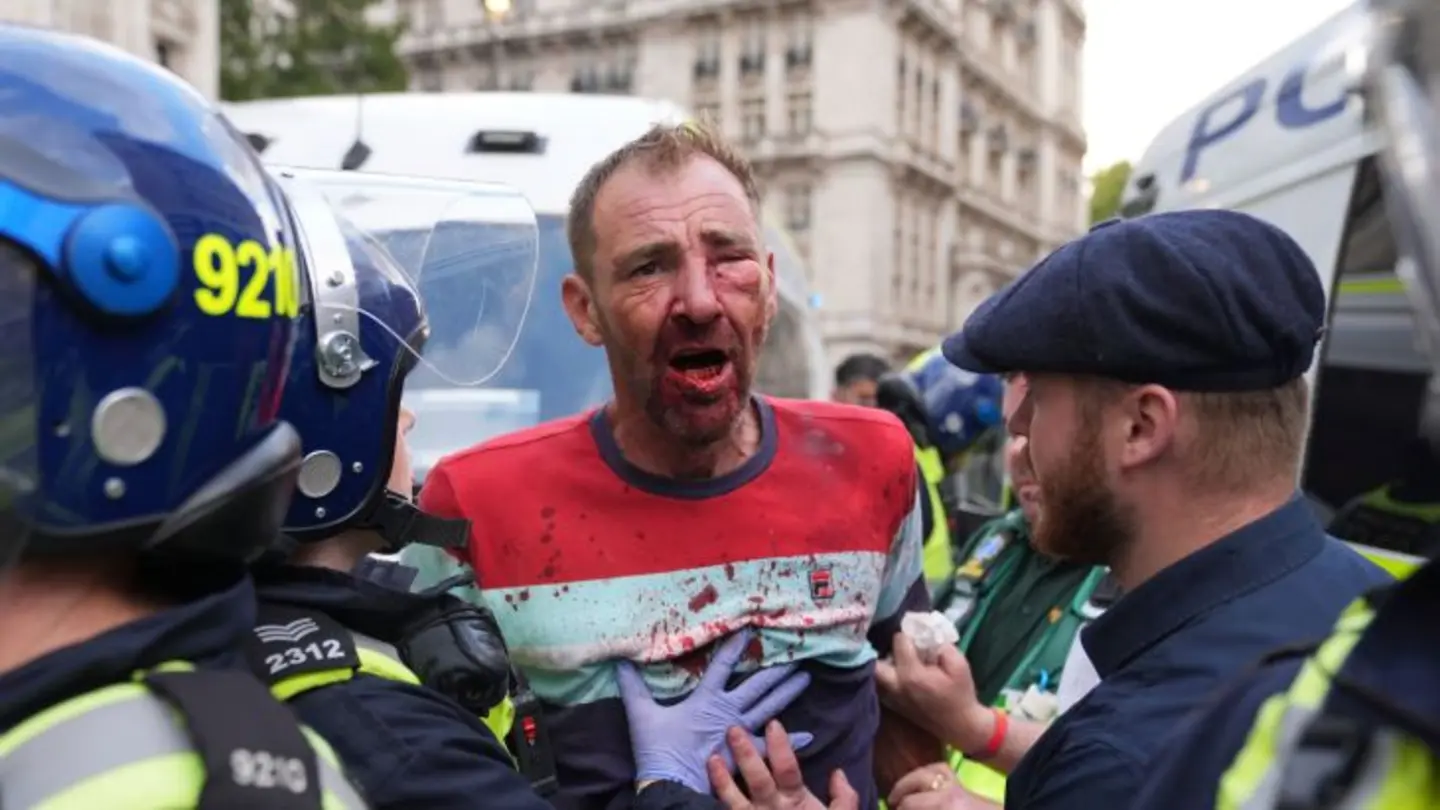 Starmer defiant against far-right protesters, vows no surrender