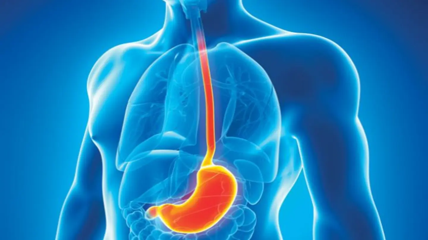 Heartburn may signal esophageal cancer, rising in the US: Doctor