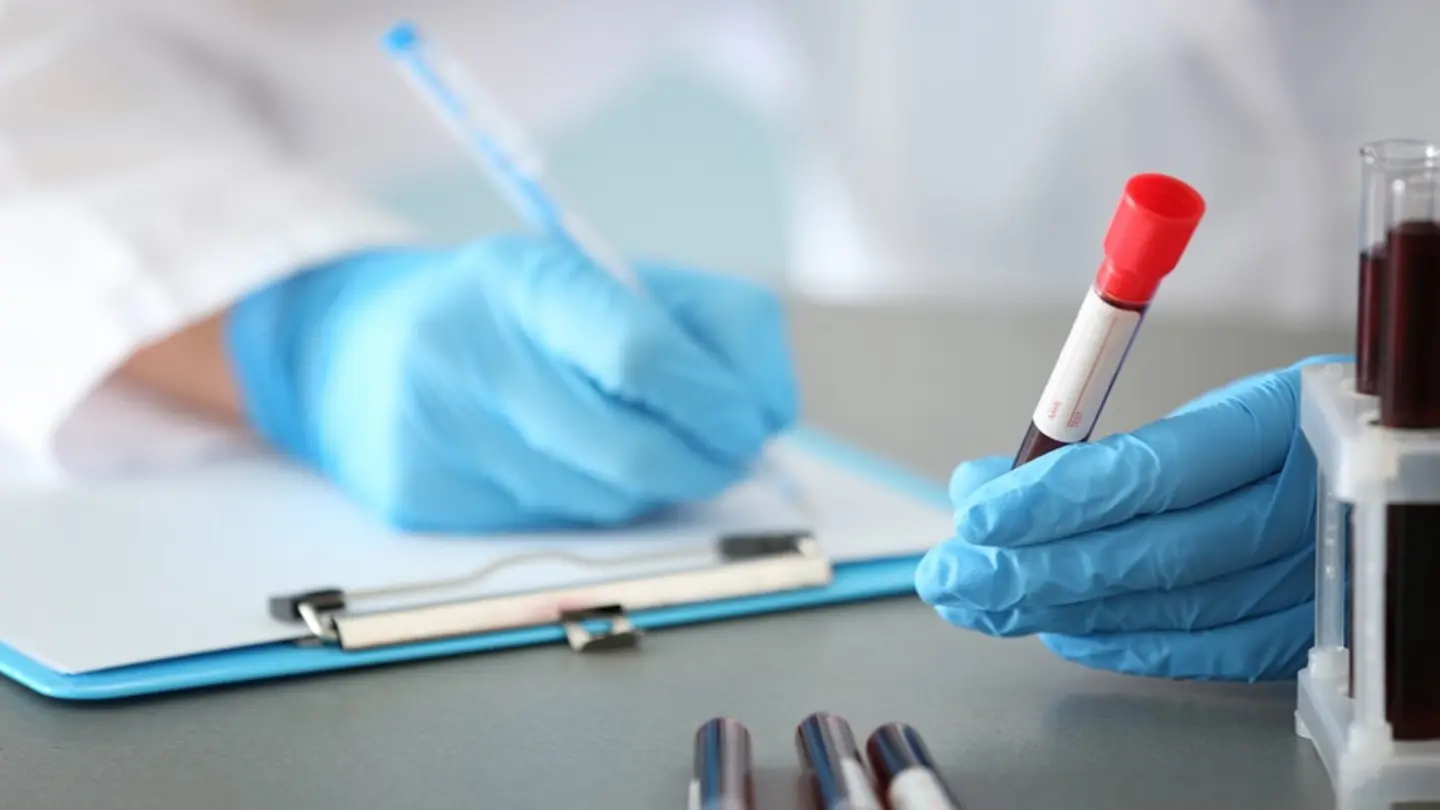 Glucocorticoids Cut Mortality in Community-Acquired Pneumonia: New Study