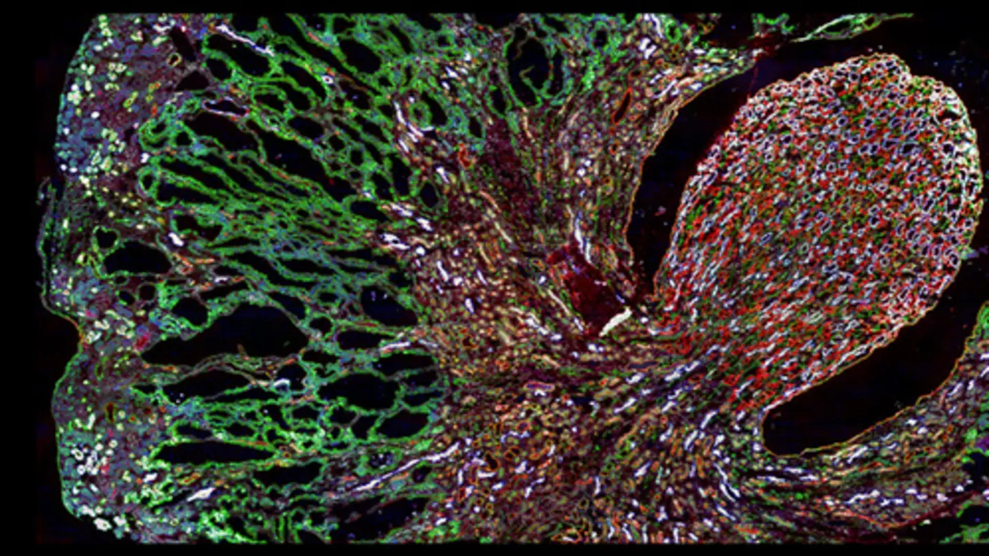 Kidney failure reversed in mice without drugs: Human trials next?