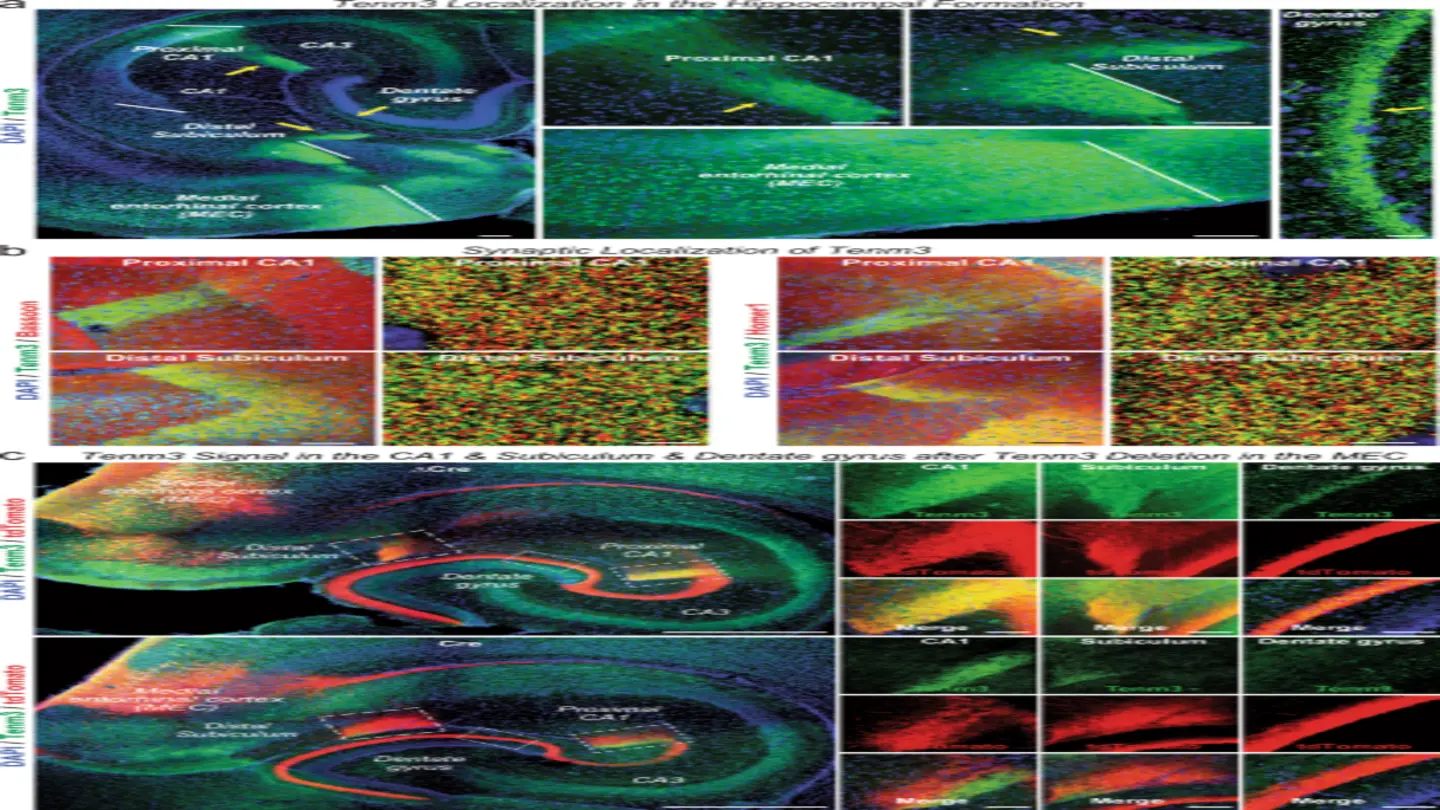 Scientists discover anti-aging protein that protects the brain from age-related damage