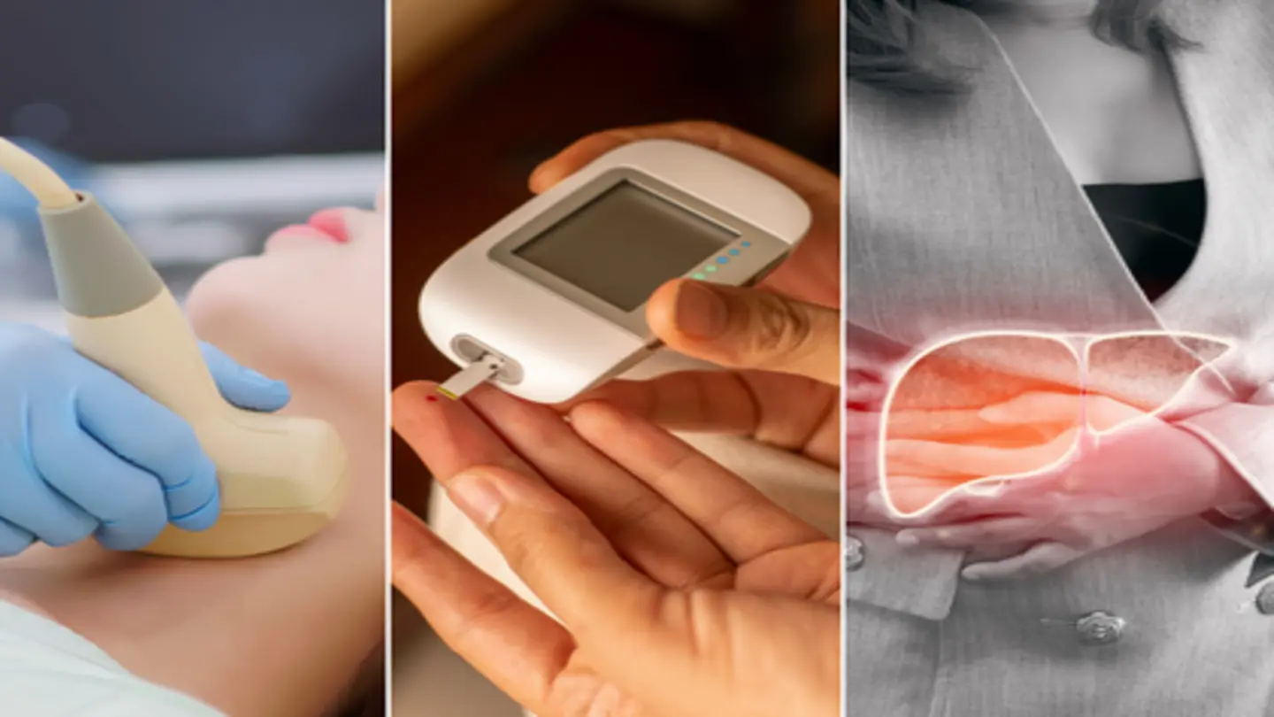 Hidden Dangers: Thyroid, Diabetes, Fatty Liver Often Show No Early Signs