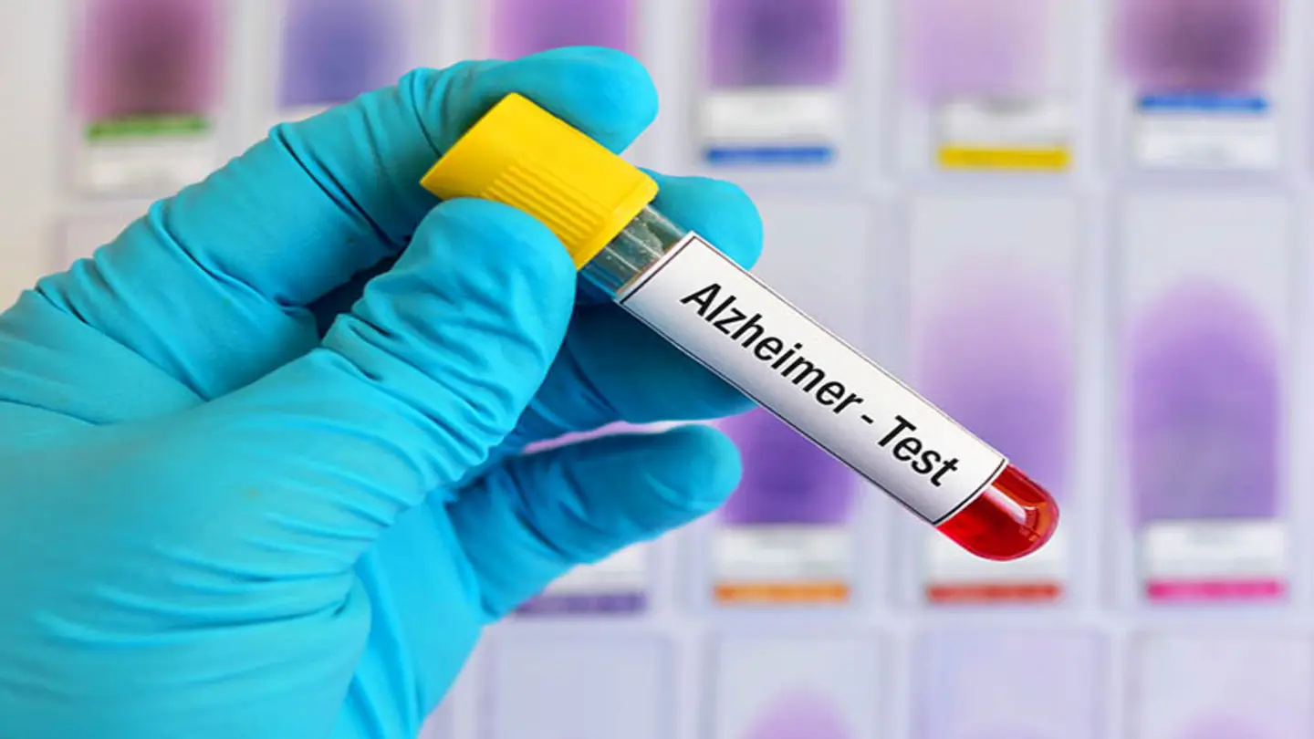 New Blood Test & Imaging Boosts Early Alzheimer’s Diagnosis