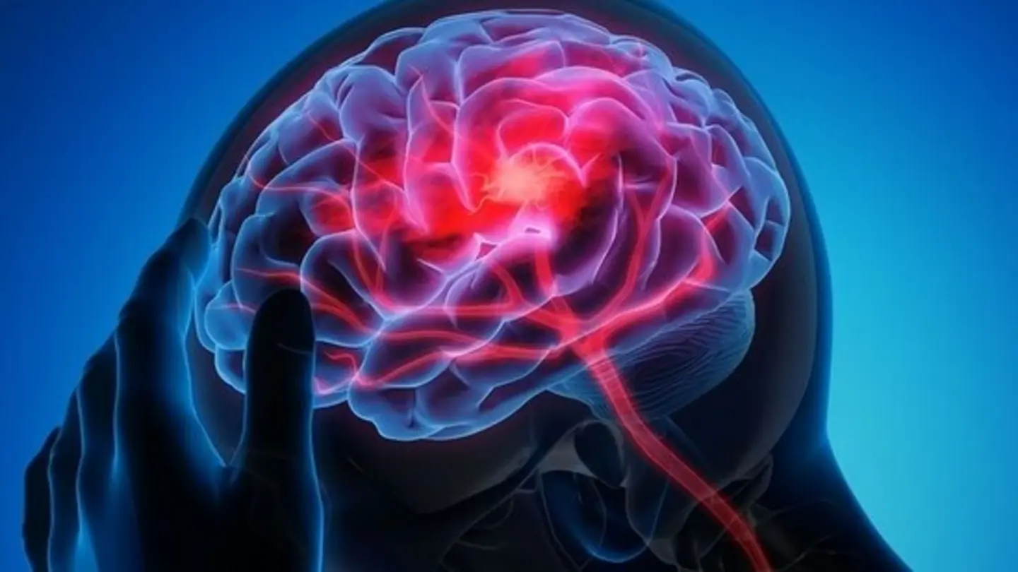Ranchi Hospitals See Brain Stroke Cases Rise with Cold Wave