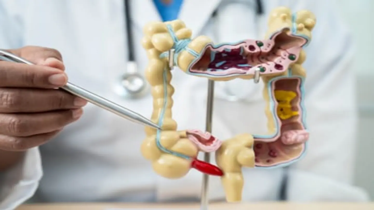 IBD Quality of Life Varies Significantly by Specific Symptoms
