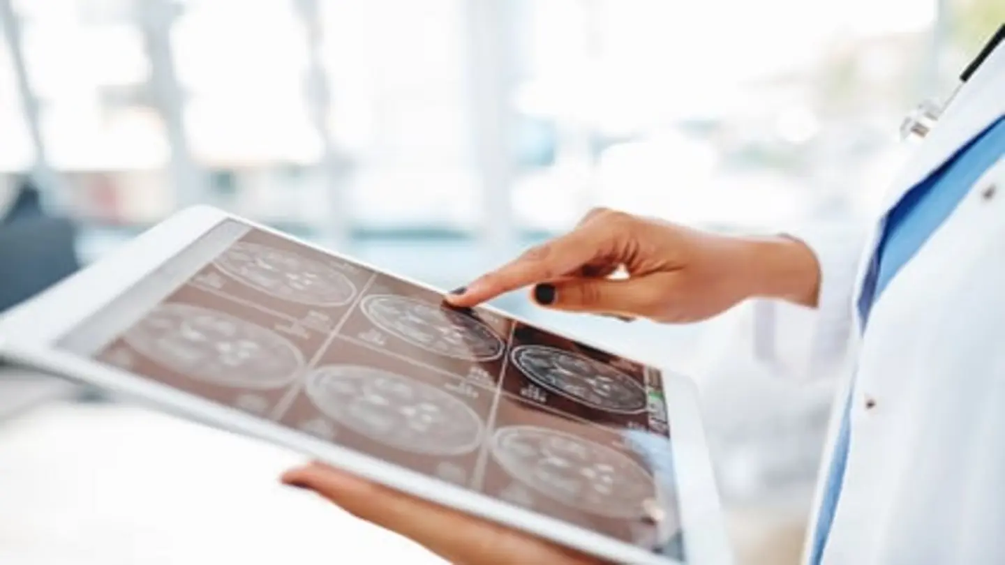 Prior Stroke Increases Ischemic Stroke Risk During Pregnancy