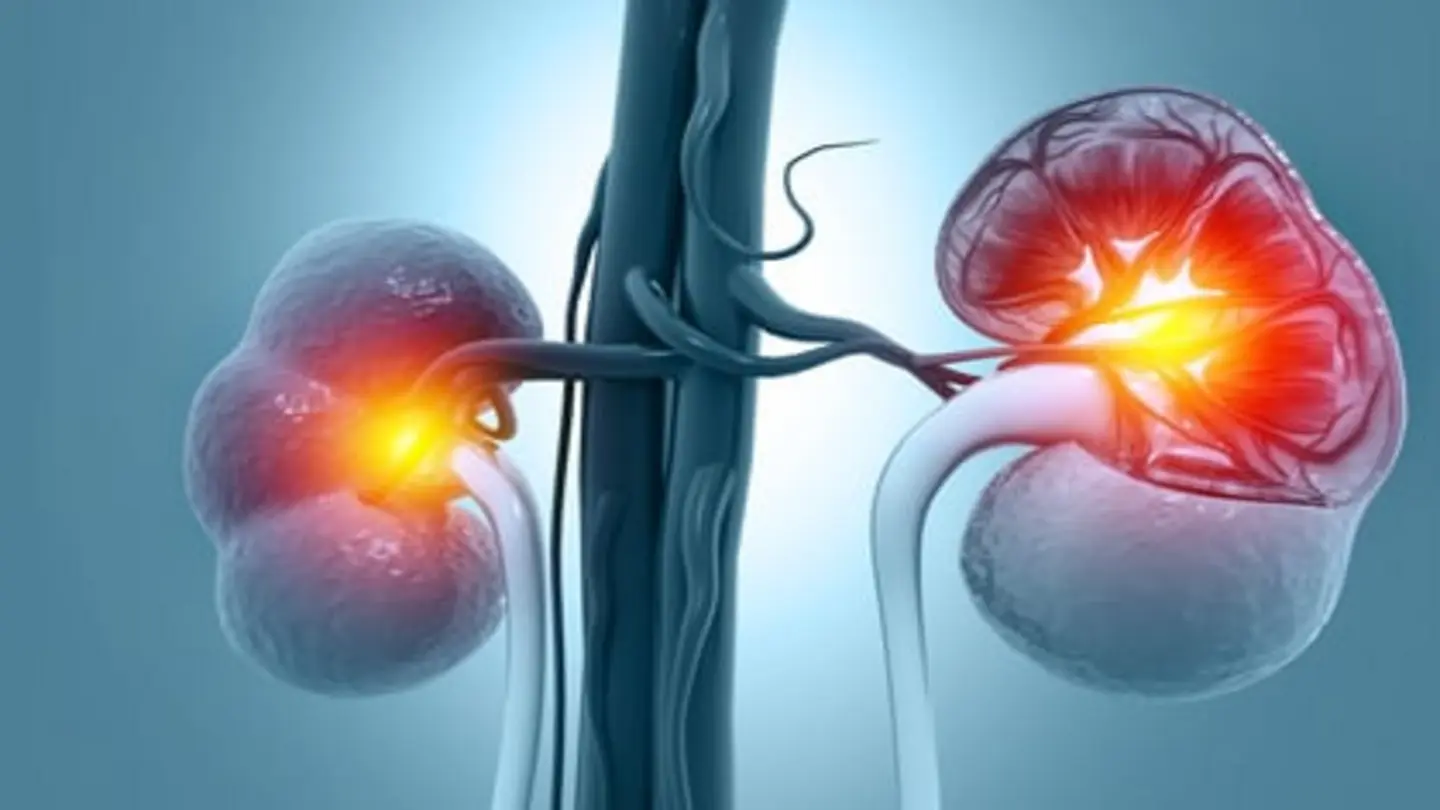 New Pathways Targeted to Preserve Kidney Function in Glomerular Disease