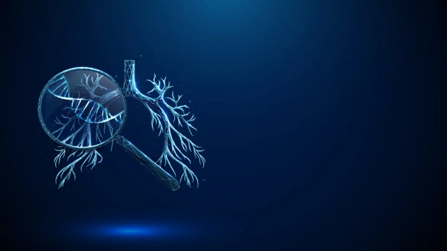 Alpha-1 Deficiency Tied to Hidden Bronchiectasis Burden