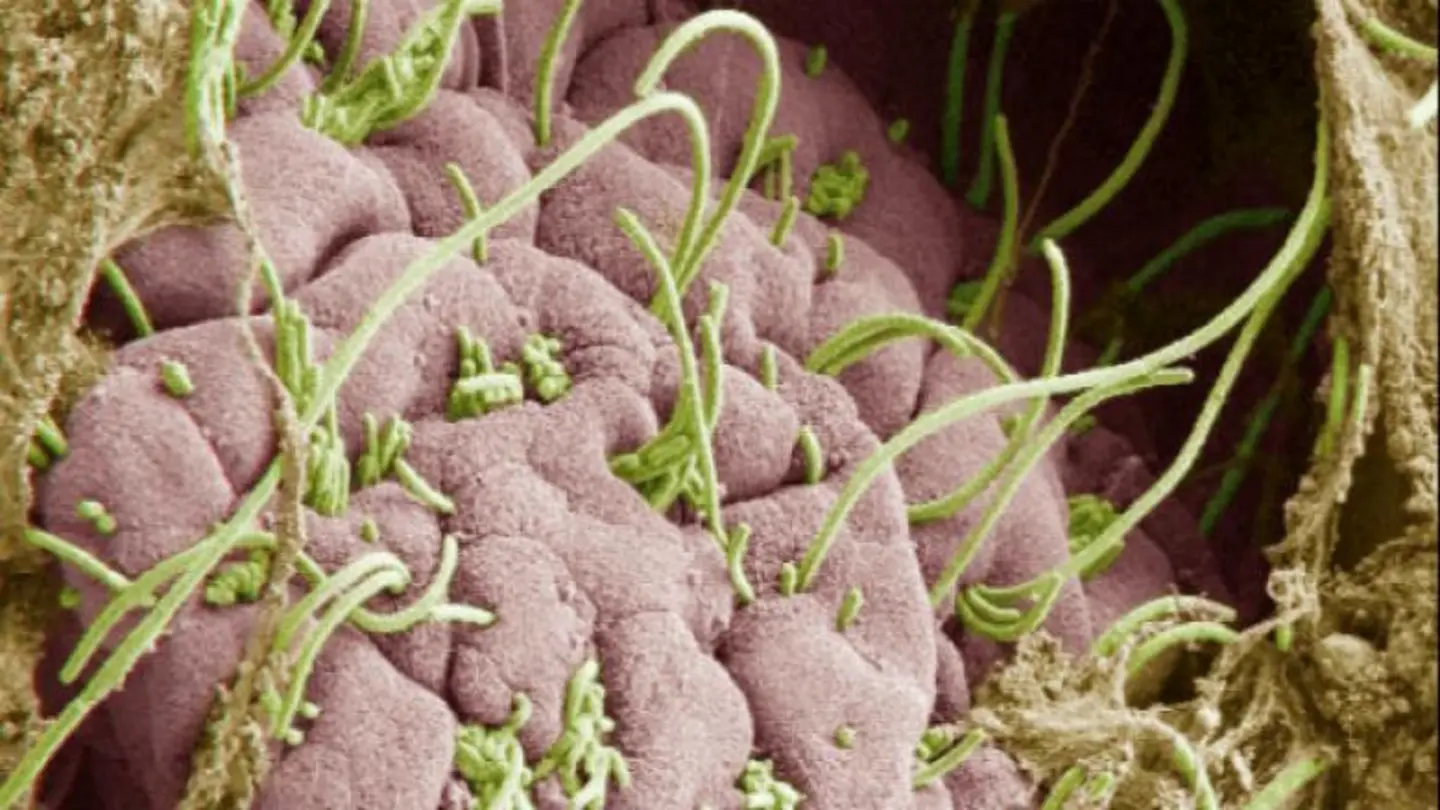 Mtb Protein Enables Immune Evasion, Stress Resistance